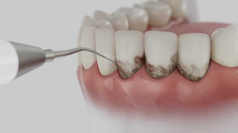 Trusted Teeth Cleaning And Checkup service in Goshen, CA - Dentist Open Now